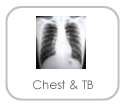 chest and TB